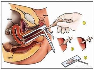 女兵体检真的很严吗？探讨女性征兵体检的标准与过程，女性征兵体检的标准与过程，女兵体检的严格程度探讨